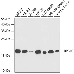 Anti-RPS10 antibody used in Western Blot (WB). GTX33475