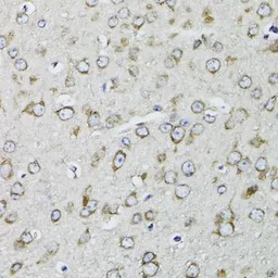 Anti-RPS10 antibody used in IHC (Paraffin sections) (IHC-P). GTX33475