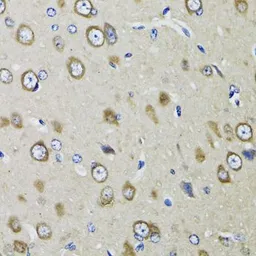 Anti-RPS10 antibody used in IHC (Paraffin sections) (IHC-P). GTX33475