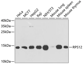 Anti-RPS12 antibody used in Western Blot (WB). GTX33476