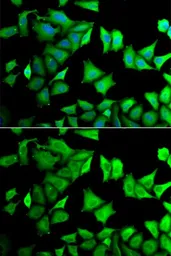 Anti-RPS12 antibody used in Immunocytochemistry/ Immunofluorescence (ICC/IF). GTX33476