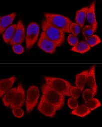 Anti-RPS12 antibody used in Immunocytochemistry/ Immunofluorescence (ICC/IF). GTX33476