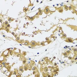 Anti-RPS12 antibody used in IHC (Paraffin sections) (IHC-P). GTX33476