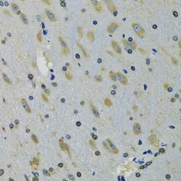 Anti-RPS12 antibody used in IHC (Paraffin sections) (IHC-P). GTX33476