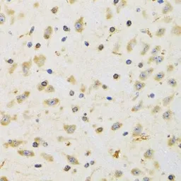 Anti-RPS12 antibody used in IHC (Paraffin sections) (IHC-P). GTX33476