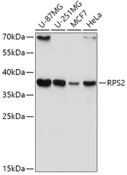 Anti-RPS2 antibody used in Western Blot (WB). GTX33477