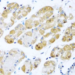 Anti-RPS2 antibody used in IHC (Paraffin sections) (IHC-P). GTX33477