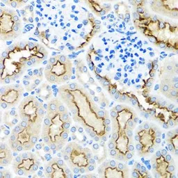 Anti-RPS2 antibody used in IHC (Paraffin sections) (IHC-P). GTX33477