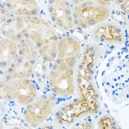 Anti-RPS2 antibody used in IHC (Paraffin sections) (IHC-P). GTX33477