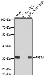 Anti-RPS3A antibody used in Immunoprecipitation (IP). GTX33478