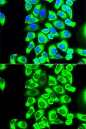 Anti-RPS3A antibody used in Immunocytochemistry/ Immunofluorescence (ICC/IF). GTX33478