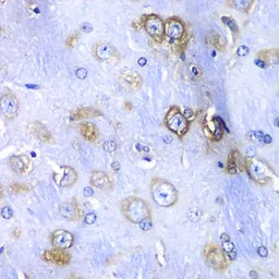 Anti-RPS3A antibody used in IHC (Paraffin sections) (IHC-P). GTX33478