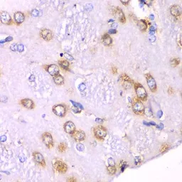 Anti-RPS3A antibody used in IHC (Paraffin sections) (IHC-P). GTX33478