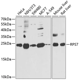 Anti-RPS7 antibody used in Western Blot (WB). GTX33479