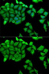 Anti-RPS7 antibody used in Immunocytochemistry/ Immunofluorescence (ICC/IF). GTX33479