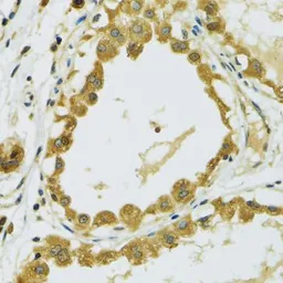 Anti-RPS7 antibody used in IHC (Paraffin sections) (IHC-P). GTX33479