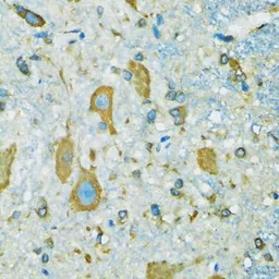 Anti-RPS7 antibody used in IHC (Paraffin sections) (IHC-P). GTX33479