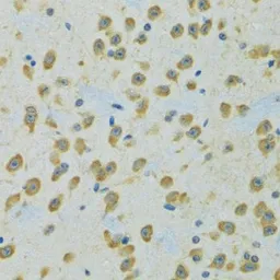 Anti-RPS7 antibody used in IHC (Paraffin sections) (IHC-P). GTX33479