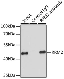 Anti-RRM2 antibody used in Immunoprecipitation (IP). GTX33480