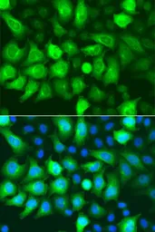 Anti-RRM2 antibody used in Immunocytochemistry/ Immunofluorescence (ICC/IF). GTX33480