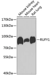 Anti-RUFY1 antibody used in Western Blot (WB). GTX33481
