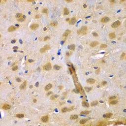 Anti-RUFY1 antibody used in IHC (Paraffin sections) (IHC-P). GTX33481