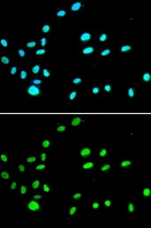 Anti-RUVBL1 antibody used in Immunocytochemistry/ Immunofluorescence (ICC/IF). GTX33482