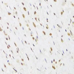 Anti-RUVBL1 antibody used in IHC (Paraffin sections) (IHC-P). GTX33482