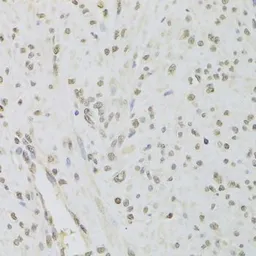Anti-RUVBL1 antibody used in IHC (Paraffin sections) (IHC-P). GTX33482