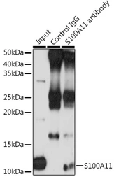 Anti-S100A11 antibody used in Immunoprecipitation (IP). GTX33483