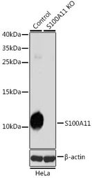 Anti-S100A11 antibody used in Western Blot (WB). GTX33483