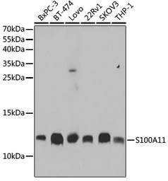 Anti-S100A11 antibody used in Western Blot (WB). GTX33483