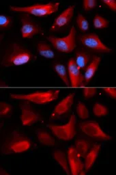 Anti-S100A11 antibody used in Immunocytochemistry/ Immunofluorescence (ICC/IF). GTX33483