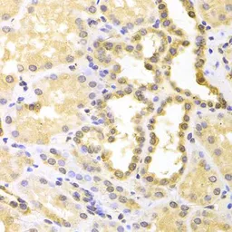 Anti-S100A11 antibody used in IHC (Paraffin sections) (IHC-P). GTX33483