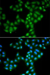Anti-SAMHD1 antibody used in Immunocytochemistry/ Immunofluorescence (ICC/IF). GTX33484