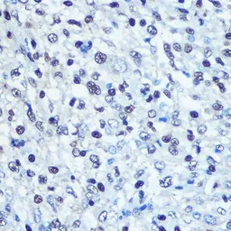 Anti-SAMHD1 antibody used in IHC (Paraffin sections) (IHC-P). GTX33484