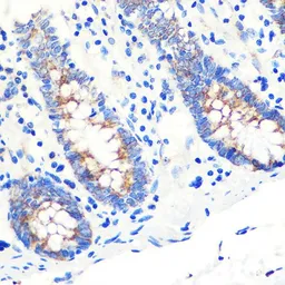 Anti-SCO2 antibody used in IHC (Paraffin sections) (IHC-P). GTX33486