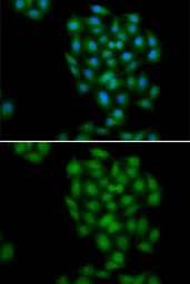 Anti-Phospholipid Scramblase 1 antibody used in Immunocytochemistry/ Immunofluorescence (ICC/IF). GTX33488