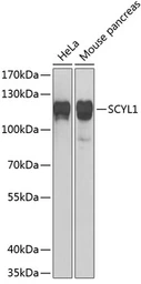 Anti-SCYL1 antibody used in Western Blot (WB). GTX33489