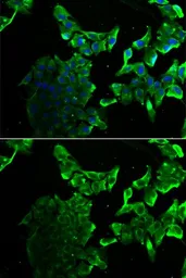Anti-SCYL1 antibody used in Immunocytochemistry/ Immunofluorescence (ICC/IF). GTX33489