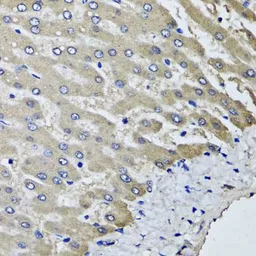 Anti-SCYL1 antibody used in IHC (Paraffin sections) (IHC-P). GTX33489