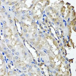 Anti-SCYL1 antibody used in IHC (Paraffin sections) (IHC-P). GTX33489