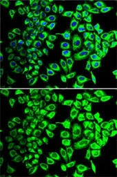 Anti-SDHA antibody used in Immunocytochemistry/ Immunofluorescence (ICC/IF). GTX33490