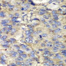 Anti-SDHA antibody used in IHC (Paraffin sections) (IHC-P). GTX33490