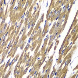 Anti-SDHA antibody used in IHC (Paraffin sections) (IHC-P). GTX33490
