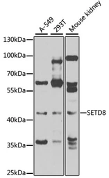 Anti-SETD8 antibody used in Western Blot (WB). GTX33491