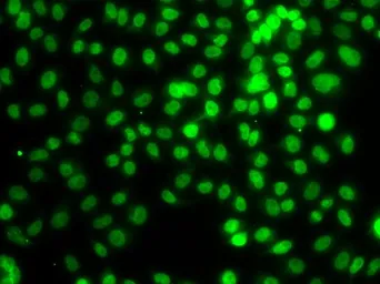 Anti-SETD8 antibody used in Immunocytochemistry/ Immunofluorescence (ICC/IF). GTX33491