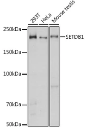 Anti-SETDB1 antibody used in Western Blot (WB). GTX33492