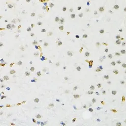 Anti-SETDB1 antibody used in IHC (Paraffin sections) (IHC-P). GTX33492