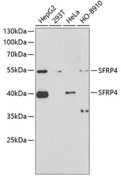 Anti-SFRP4 antibody used in Western Blot (WB). GTX33493